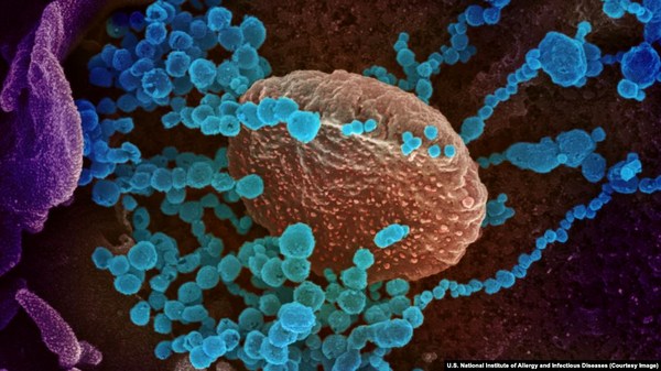 Фото дня Вирионы SARS-CoV-2 разрастаются в клетке человеческого организма