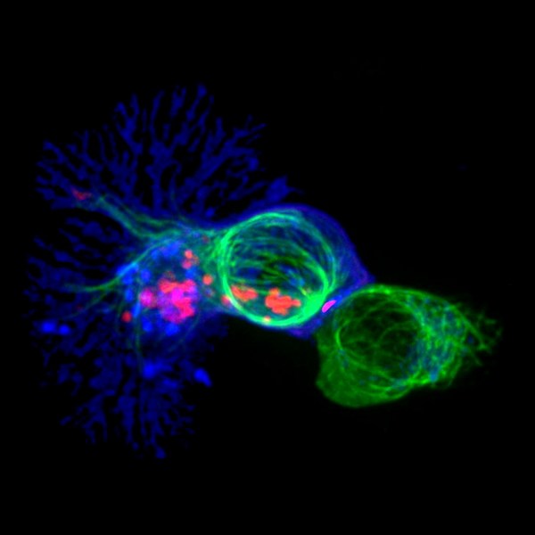 Цитотоксический Т-лимфоцит (слева), атакующий раковую клетку (справа). (Фото: NI