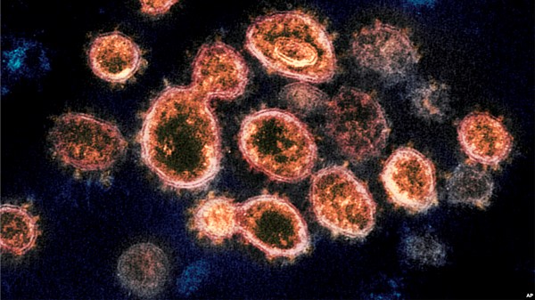 Фото:  Частицы вируса Sars-COV-2 под электронным микроскопом