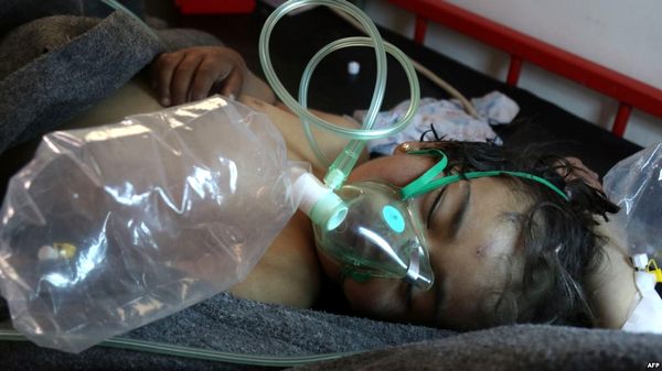 Фото:  Ребенок, пострадавший от предположительного применения химического оружия
