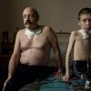 Больные раком щитовидной железы, Олег Шапиро, 54 года, и тринадцатилетний Дима Богданович в эндокринологической клинике в Минске