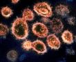 Фото:  Частицы вируса Sars-COV-2 под электронным микроскопом