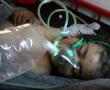 Фото:  Ребенок, пострадавший от предположительного применения химического оружия