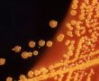 Фото:  Колония бактерии E. Coli (кишечная палочка). Она обычно безвредна, но нек