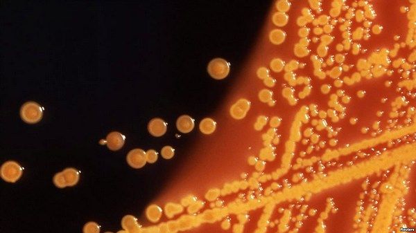 Фото:  Колония бактерии E. Coli (кишечная палочка). Она обычно безвредна, но нек