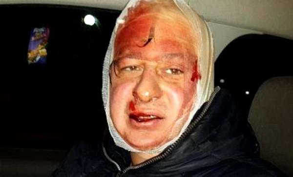 Фото:  Александр Перевозник пострадал во время вытеснения "Беркутом" людей 